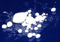 250px-Mercury_Chloride